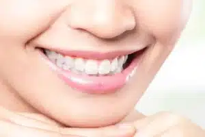 Close-up of a smiling person with bright white teeth, representing the results of professional teeth whitening for a brighter, healthier-looking smile.