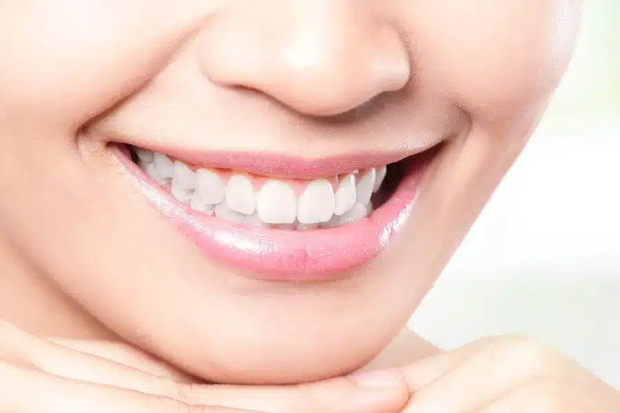 Close-up of a smiling person with bright white teeth, representing the results of professional teeth whitening for a brighter, healthier-looking smile.